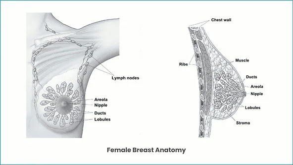 breat cancer diagram
